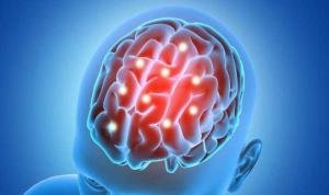 Kata Dokter, Jangan Lakukan 5 Kebiasaan Ini di Malam Hari untuk Cegah Stroke